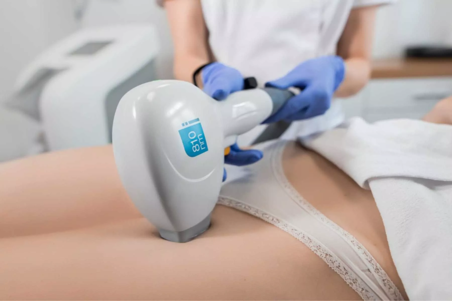 Depilacja laserowa — laser diodowy 810 nm