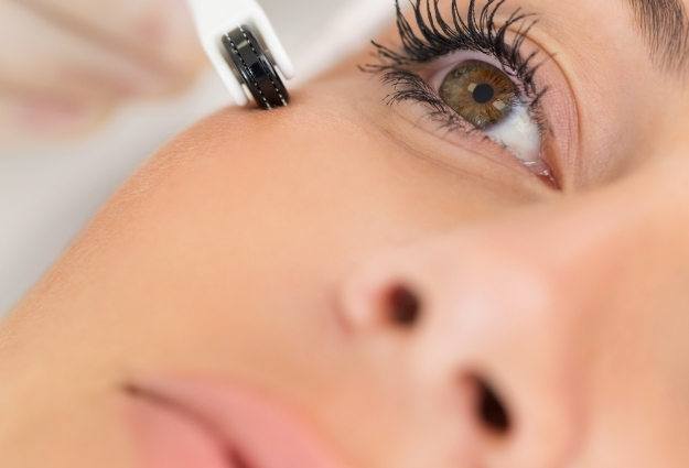 Mezoterapia igłowa w Multi Kosmetyka Siedlce — zabieg anti-aging